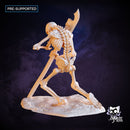 Skeleton Pikeman A - Only-Games