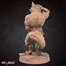 Jack Hugeman, the Worgen Rockstar - Only-Games