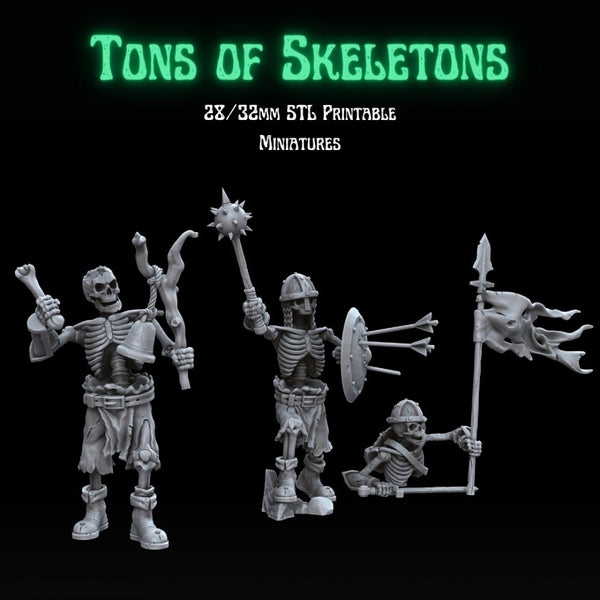 Tons of Skeletons: Equipped Skeletons Command Group - Only-Games